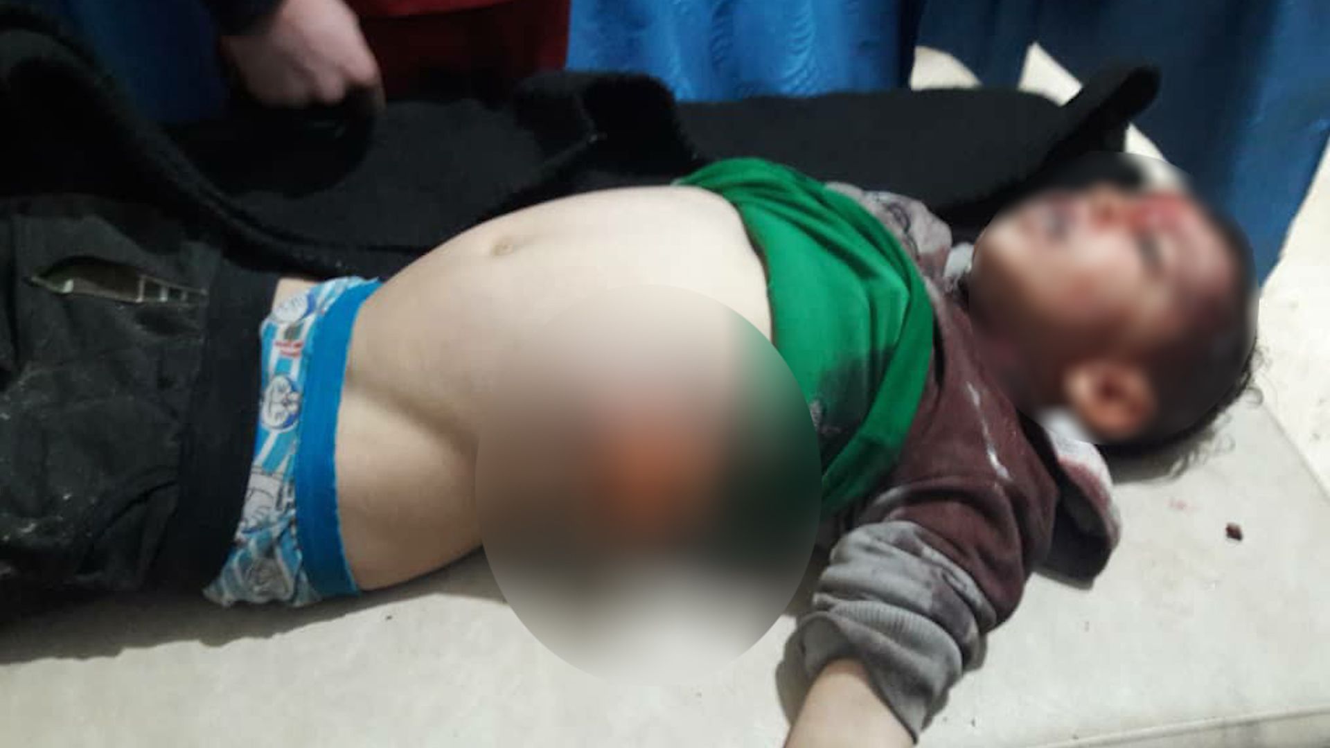 استشهاد طفل يبلغ من العمر 5 سنوات في قصف للاحتلال ومرتزقته على تل رفعت