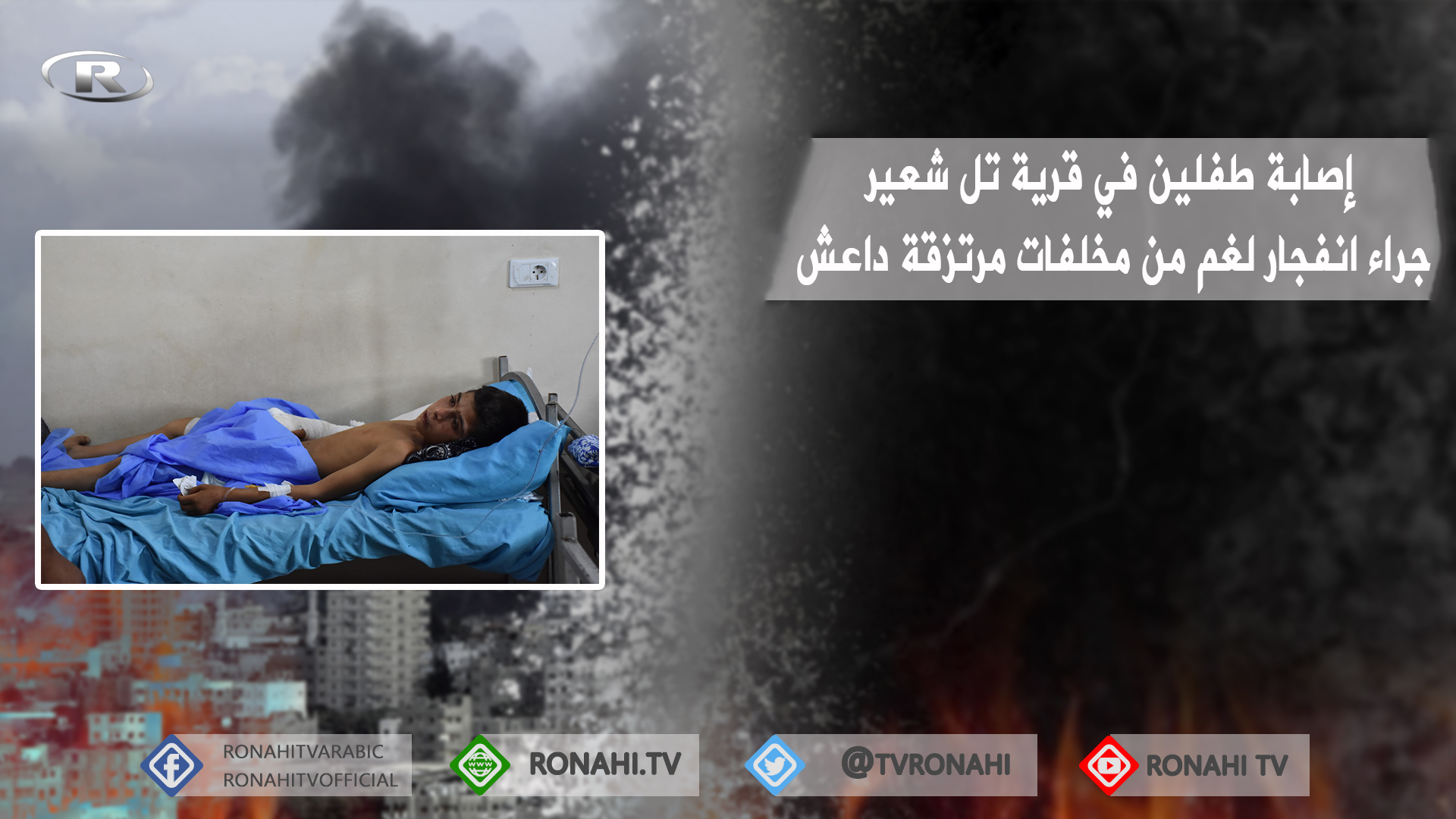 إصابة طفلين في قرية تل شعير التابعة للشهباء جراء انفجار لغم من مخلفات مرتزقة داعش