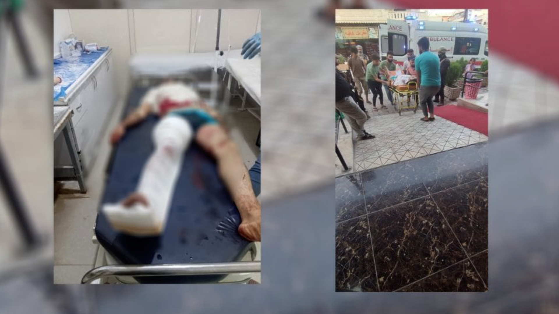 إثر إطلاق نار..إصابة مواطن في ريف عفرين المحتلة من قبل مستوطن