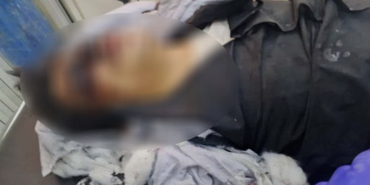 انفجار في ريف الشدادي يودي بحياة شخص وبتر قدم آخر