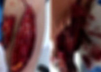 إصابة طفل بجروح بعد تعرضه لعضة أسد في حديقة حيوانات بقامشلو
