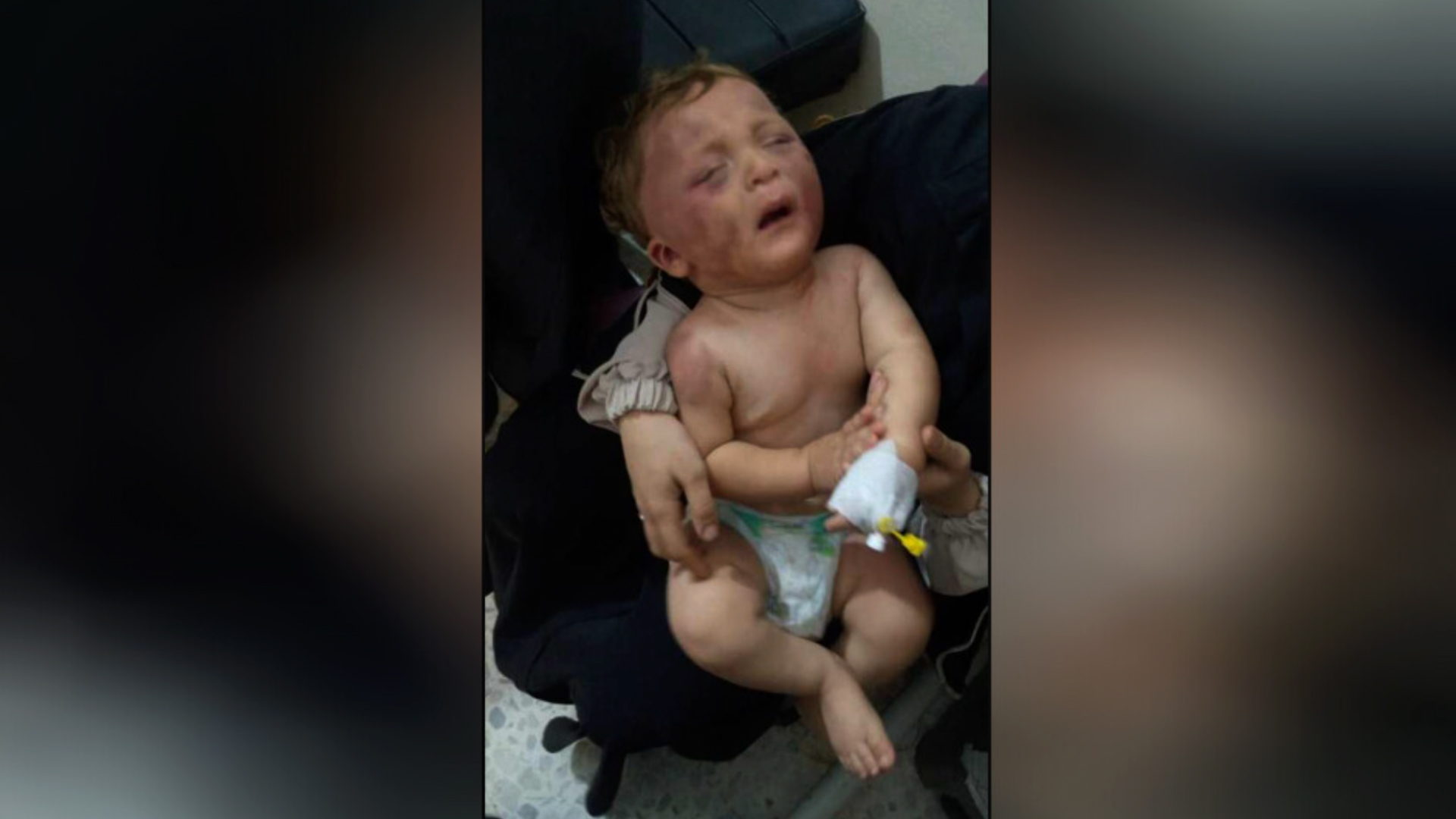 LI Idlibê çeteyekî dewleta Tirk êşkence li zarokekê kir