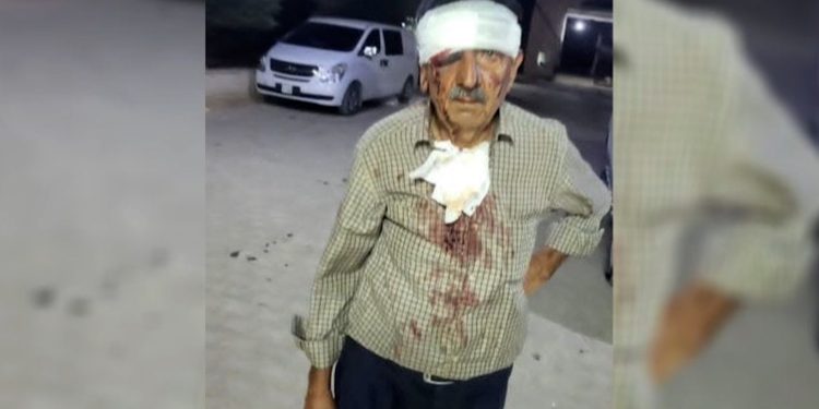 Efrîn-Çekdaran êşkence li şêniyan kirin û pereyên wan dizîn