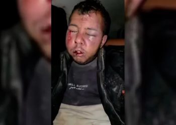 Li Serêkaniyê 5 kes bi guleyên Tirkiyê birîndar bûn